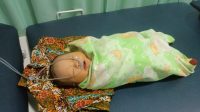 Bayi Perempuan Lahir Tanpa Anus, Donasi Mengalir untuk Bantuan Pengobatan
